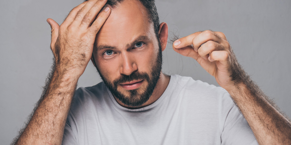 Patient leidet an Haarausfall