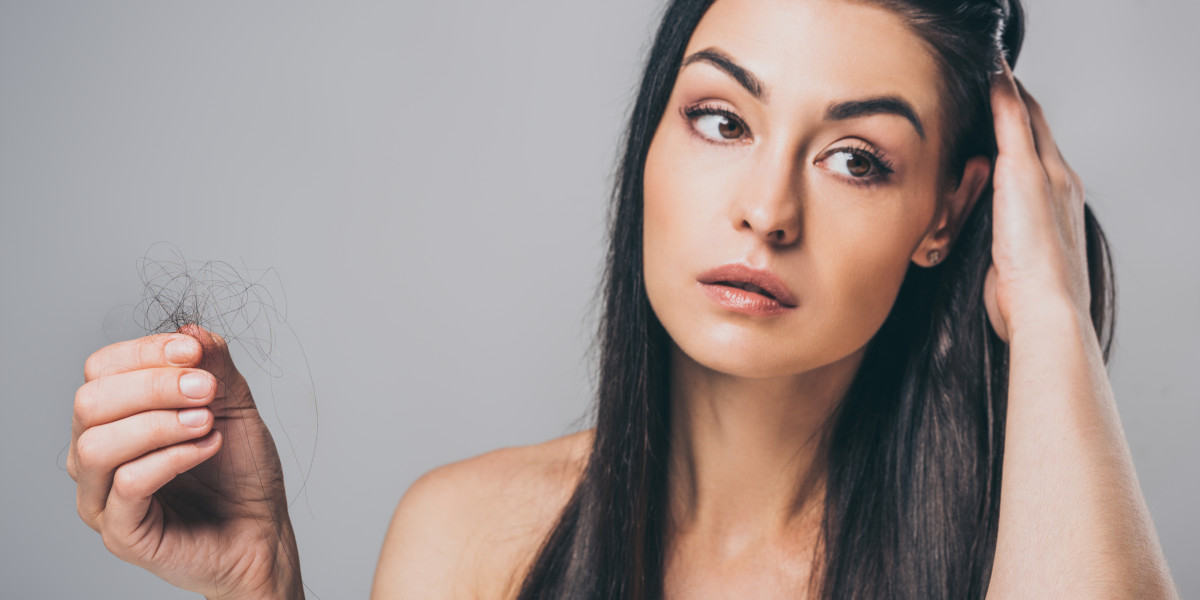 Patientin vor Ihrer Behandlung gegen Haarausfall