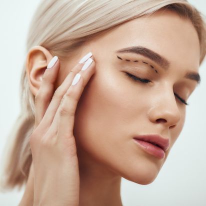 Lidstraffung Berlin - Frau nach Ihrer Oberlidstraffung