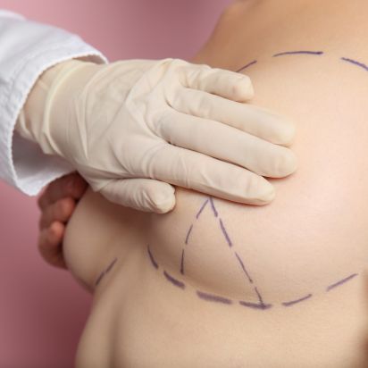 Die Brustverkleinerung ist kein risikoreicher Eingriff, sollte dennoch nur von einem spezialisierten Chirurgen vorgenommen werden.